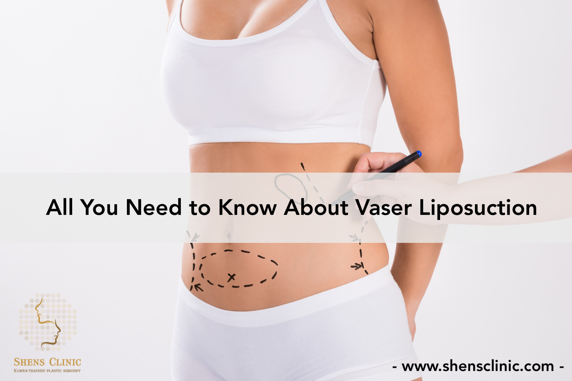 22 Wonderful What is Vaser Liposuction 2024 free download what is vaser liposuction of vaser liposuction 4d hi definition archives shens clinic regarding category vaser liposuction 4d hi definition